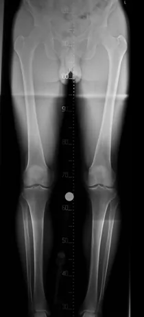 Postoperative xray 01